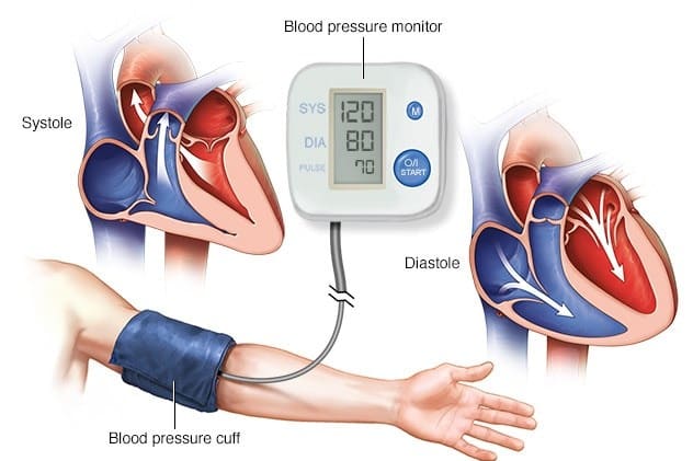 Hypertension Checkup - Dr. Debabrata Sarkar